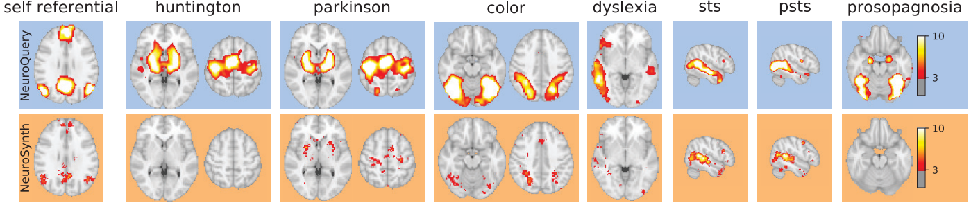 ../../_images/Neuroquery_03_Prosopagnosia.png