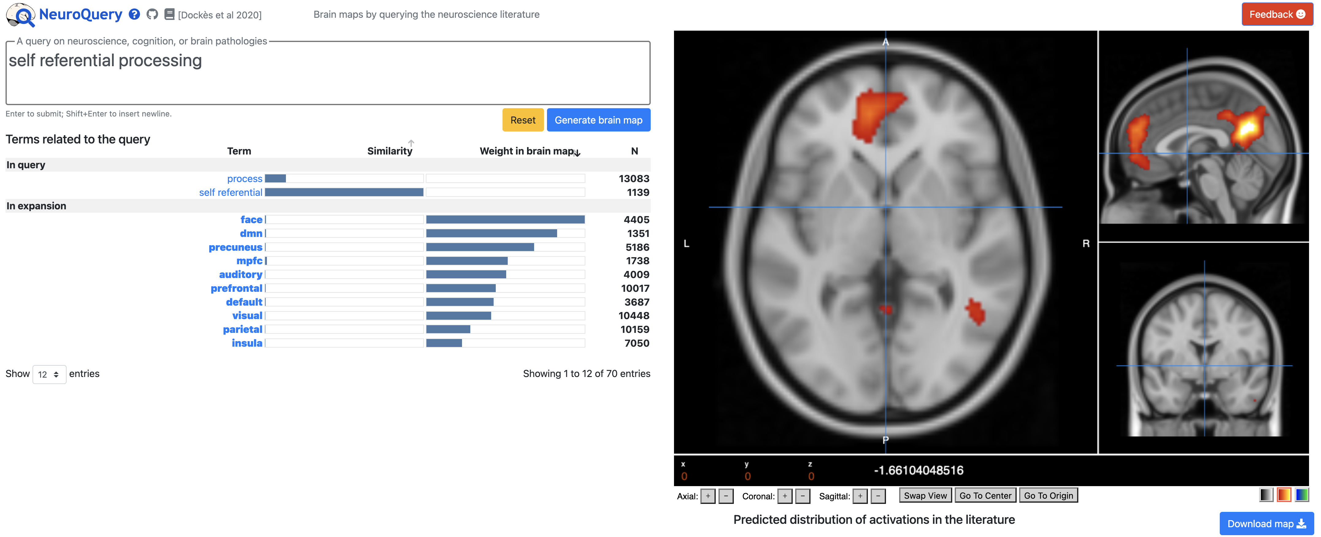 ../../_images/Neuroquery_03_Website.png