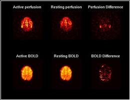 ../_images/asl_vs_bold.jpg
